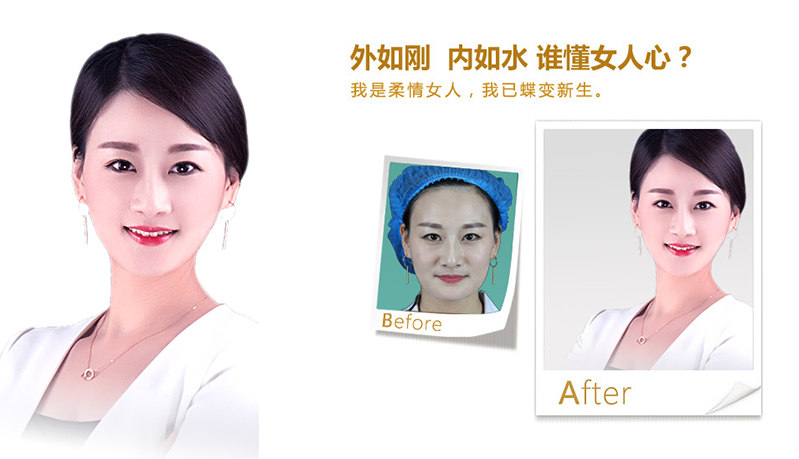 广州V脸、线雕隆鼻